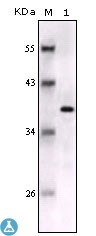 Western Blot (WB) analysis using S-100 beta Monoclonal Antibody against full-length S-100 beta recombinant protein.