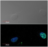 Immunocytochemistry detection of Ki-67 in U2OS cell line (human osteosarcoma) using monoclonal antibody Ki-67 (green). Cell nuclei stained with DAPI (blue)