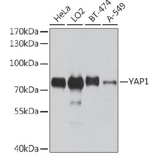Western blot analysis of extracts of
various cell lines, using YAP1 antibody
at 1:1000 dilution. Secondary antibody:
HRP Goat Anti- Rabbit IgG (H+L)at
1:10000 dilution.
Lysates/proteins: 25ug per lane.
Blocking buffer: 3% nonfat dry milk in
TBST.
Detection: ECL West Pico Plus
Exposure time: 10s.