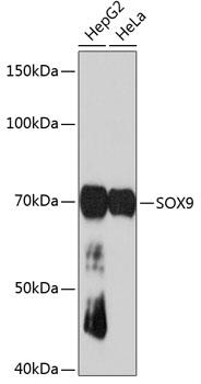 Western blot analysis of extracts of
various cell lines, using SOX9
antibody at 1:1000 dilution.
Secondary antibody: HRP Goat Anti-
Rabbit IgG (H+L) at 1:10000
dilution.
Lysates/proteins: 25ug per lane.
Blocking buffer: 3% nonfat dry milk in
TBST.
Detection: ECL West Pico Plus.
Exposure time: 3min.