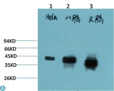 Western Blot (WB) analysis of 1) HeLa Cell Lysate, 2)Mouse Brain Tissue Lysate, 3) Rat Brain Tissue Lysate using ERK1/2 Mouse Monoclonal Antibody diluted at 1:2000.
