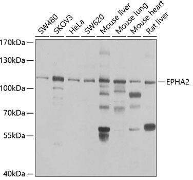 Western blot analysis of extracts of various cell lines, using EPHA2 antibody 1:1000 dilution.
Secondary antibody: HRP Goat Anti- Rabbit IgG (H+L)at 1:10000
dilution.
Lysates/proteins: 25ug per lane.
Blocking buffer: 3% nonfat dry milk in TBST.
Detection: ECL West Pico Plus
Exposure time: 10s.