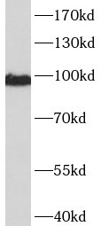 NIH/3T3 cells were subjected to SDS PAGE followed by western blot with (CTNNA1 Antibody) at dilution of 1:1000