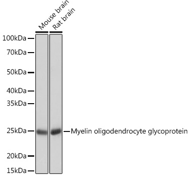 Western blot analysis of extracts of various cell lines, using Myelin oligodendrocyte glycoprotein
antibody at 1:1000 dilution. Secondary antibody: HRP Goat Anti-Rabbit IgG (H+L) at 1:10000 dilution.
Lysates/proteins: 25μg per lane. Blocking buffer: 3% nonfat dry milk in TBST. Detection: ECL West Pico Plus.
Exposure time: 10s.