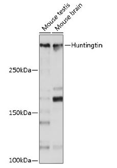 Western blot analysis of extracts of
various cell lines, using Huntingtin
antibody at 1:1000 dilution.
Secondary antibody: HRP Goat Anti-
Rabbit IgG (H+L) at 1:10000
dilution.
Lysates/proteins: 25ug per lane.
Blocking buffer: 3% nonfat dry milk in
TBST.
Detection: ECL West Pico Plus.
Exposure time: 10s.