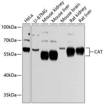 Western blot analysis of extracts of various cell lines, using CAT Antibody at 1:3000 dilution.
Secondary antibody: HRP Goat Anti-Rabbit IgG (H+L) at 1:10000 dilution.
Lysates/proteins: 25ug per lane.
Blocking buffer: 3% nonfat dry milk in TBST.
Detection: ECL West Pico Plus.
Exposure time: 5s.