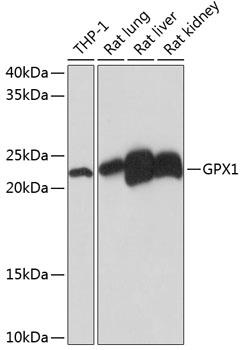 Western blot analysis of extracts of
various cell lines, using GPX1 Rabbit mAb
at 1: 1000 dilution.
Secondary antibody: HRP Goat Anti-Rabbit
IgG (H+L) at 1:10000 dilution.
Lysates/proteins: 25ug per lane.
Blocking buffer: 3% nonfat dry milk in TBST.
Detection: ECL West Pico Plus.
Exposure time: 10s.