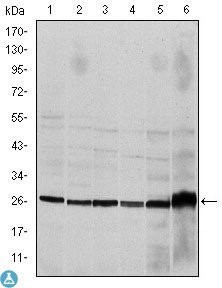 Western Blot (WB) analysis using Caspase-8 Monoclonal Antibody against HeLa (1), Jurkat (2), THP-1 (3), NIH/3T3 (4), Cos7 (5) and PC-12 (6) cell lysate.
