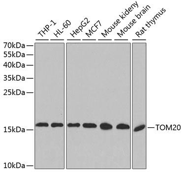 Western blot analysis of extracts of various cell lines, using TOM20 antibody at 1:1000
dilution.
Secondary antibody: HRP Goat Anti-Rabbit IgG (H+L) at 1:10000 dilution.
Lysates/proteins: 25ug per lane.
Blocking buffer: 3% nonfat dry milk in TBST.
Detection: ECL West Pico Plus.  
Exposure time: 60s.