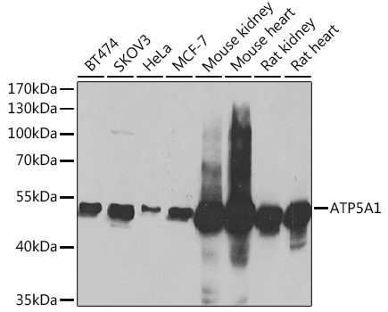 WB analysis of extracts of various cell lines, using ATP5A1 Antibody at 1:1000 dilution.
Secondary antibody: HRP Goat Anti-Rabbit IgG (H+L) at 1:10,000 dilution.
Lysates/proteins: 25ug per lane.
Blocking buffer: 3% nonfat dry milk in TBST.
Detection: ECL West Pico plus Kit .Exposure time: 1s