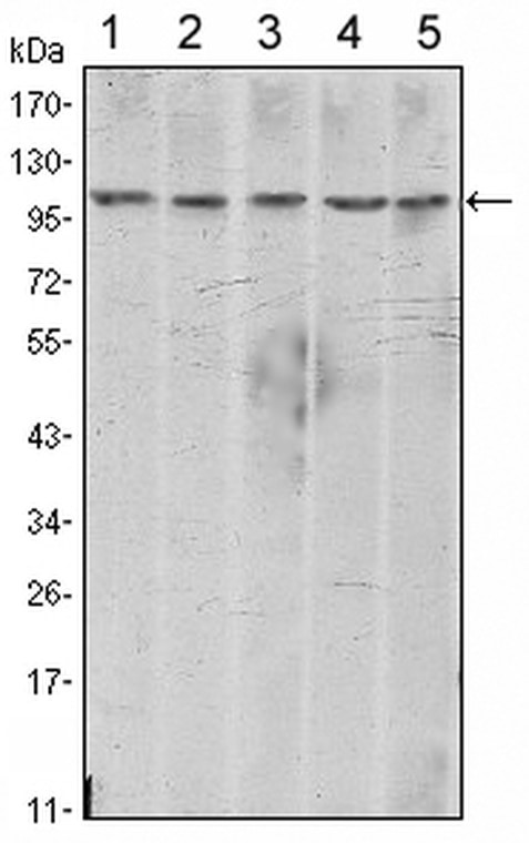 Western blot analysis using N-cadherin monoclonal antibody  against A431 (1) , NIH/3T3 (2) , HeLa (3) , C6 (4) and LNCap (5) cell lysate.