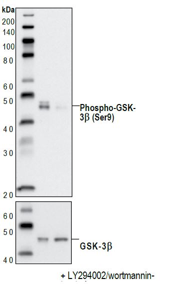 Western blot analysis of extracts from PC-3 cells, untreated or LY294002/wortmannin-treated, using Phospho-GSK-3beta (Ser9) (Rabbit mAb (upper) or GSK-3beta Rabbit (lower).
