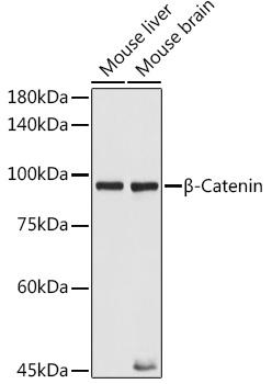 Western blot analysis of extracts of various cell lines, using β-Catenin antibody at 1:1000 dilution. Secondary antibody: HRP Goat Anti-Mouse IgG (H+L)  at 1:10000 dilution.Lysates/proteins: 25ug per lane.
Blocking buffer: 3% nonfat dry milk in TBST.
Detection: ECL West Pico Plus Exposure time: 1s.