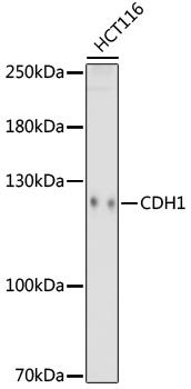 Western blot analysis of extracts of HCT116 cells, using CDH1 antibody at 1:1000 dilution.
Secondary antibody: HRP Goat Anti-Rabbit IgG (H+L) at 1:10000 dilution.
Lysates/proteins: 25ug per lane.
Blocking buffer: 3% nonfat dry milk in TBST.
Detection: ECL West Pico Plus.
Exposure time: 180s.