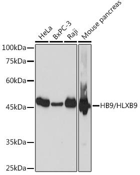 Western blot analysis of extracts of
various cell lines, using MNX1
Rabbit mAb at 1:1000 dilution.
Secondary antibody: HRP Goat
Anti-Rabbit IgG (H+L) at 1:10000 dilution.
Lysates/proteins: 25ug per lane.
Blocking buffer: 3% nonfat dry milk in TBST.
Detection: ECL West Pico Plus.
Exposure time: 1s.