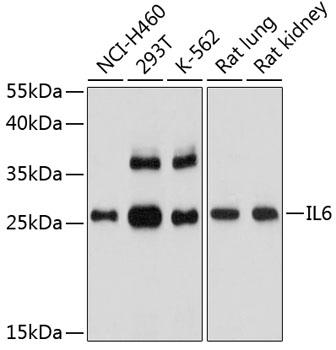 Western blot analysis of extracts of various
cell lines, using IL6 antibody at 1:1000 dilution.
Secondary antibody: HRP Goat Anti-Rabbit IgG
(H+L) at 1:10000 dilution.
Lysates/proteins: 25ug per lane.
Blocking buffer: 3% nonfat dry milk in TBST.
Detection: ECL West Pico Plus.
Exposure time: 90s.