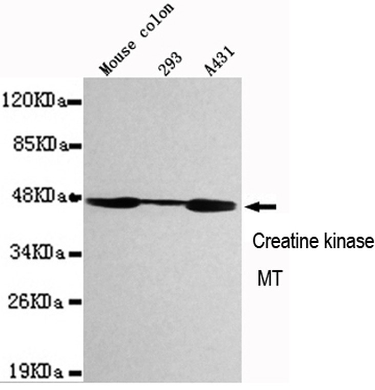 Western blot detection of CKMT1 in Mouse Colon,  293 and A431 cell lysates using CKMT1 mouse mAb  (1:1000 diluted).
Predicted band size:47KDa.
Observed band size:47KDa.