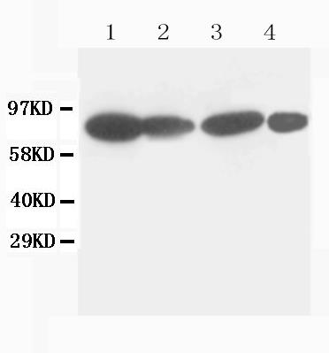 Anti-Catenin gamma(Plakoglobin) antibody (monoclonal),
Western blotting
Lane 1: MCF-7 Cell Lysate
Lane 2: HELA Cell Lysate
Lane 3: MM231 Cell Lysate
Lane 4: HT1080 Cell Lysate