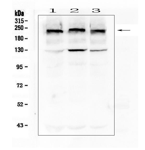 Western blot analysis of Collagen IV using anti-
Collagen IV antibody ( Electrophoresis was performed on a 8% SDS-PAGE gel at 70V (Stacking gel) / 90V (Resolving gel) for 2-3 hours. The sample well of each lane was loaded with 50ug of sample under
reducing conditions.
Lane 1: human HEK293T whole cell lysate,
Lane 2: human Hela whole cell lysate,
Lane 3: human A549 whole cell lysate.
After Electrophoresis, proteins were transferred to a Nitrocellulose membrane at 150mA for 50-90 minutes. Blocked the membrane with 5% Non-fat Milk/ TBS for 1.5 hour at RT. The membrane was incubated with mouse anti-Collagen IV antigen affinity purified monoclonal antibody at 0.5 μg/mL overnight at 4°C, then washed with TBS-0.1%Tween 3 times with 5 minutes each and probed with a goat anti-mouse IgG-HRP secondary antibody at a dilution of 1:10000 for 1.5 hour at RT. The signal is developed using an Enhanced Chemiluminescent detection (ECL1) with Tanon 5200 system. A specific band was detected for Collagen IV at approximately 220KD. The expected band size for Collagen IV is at 161KD.