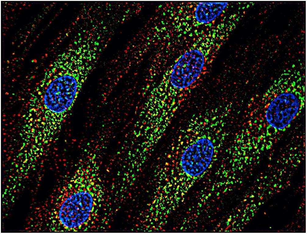 Immunocytochemistry staining of human skin fibroblasts with anti-CD63 (MEM-259; green) after co-incubation of living cells with human Transferrin - 547 cell nuclei stained with DAPI (blue)