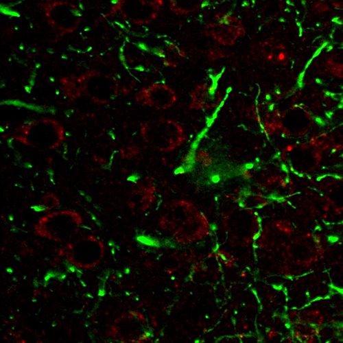 Immunohistochemistry staining of CD107a (red) in tissue sections of murine brain expressing GFP in some of its neurons (green). Mouse monoclonal antibody H4A3 (anti-CD107a) was detected with goat anti-mouse IgG1 conjugated with Alexa Fluor 555.