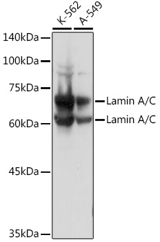 Western blot analysis of extracts of various cell lines, using Lamin A/C Rabbit pAb at 1:3000 dilution.
Secondary antibody: HRP Goat Anti-Rabbit IgG (H+L) at 1:10000 dilution.
Lysates/proteins: 25ug per lane.
Blocking buffer: 3% nonfat dry milk in TBST.
Detection: ECL West Pico Plus.
Exposure time: 1s.