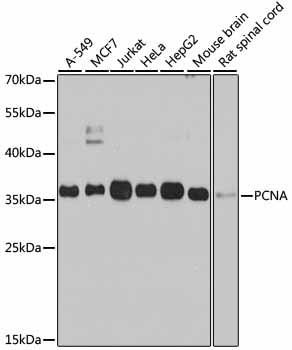 Western blot analysis of extracts of various cell lines, using PCNA antibody at 1:1000 dilution.
Secondary antibody: HRP Goat Anti-Rabbit IgG (H+L) at 1:10000 dilution.
Lysates/proteins: 25ug per lane.
Blocking buffer: 3% nonfat dry milk in TBST.
Detection: ECL West Pico Plus.
Exposure time: 60s.