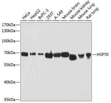 Western blot analysis of extracts of various cell  lines, using HSP70 antibody at 1:3000 dilution.
Secondary antibody: HRP Goat Anti-Rabbit IgG (H+L) at 1:10000 dilution.
Lysates/proteins: 25ug per lane.
Blocking buffer: 3% nonfat dry milk in TBST.
Detection: ECL West Pico Plus
Exposure time: 10s.