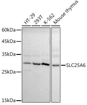 Western blot analysis of extracts of various cell lines, using SLC25A6 antibody at 1:1000 dilution.
Secondary antibody: HRP Goat Anti-Rabbit IgG (H+L) at 1:10000 dilution.
Lysates/proteins: 25ug per lane.
Blocking buffer: 3% nonfat dry milk in TBST.
Detection: ECL West Pico Plus. 
Exposure time: 1s.