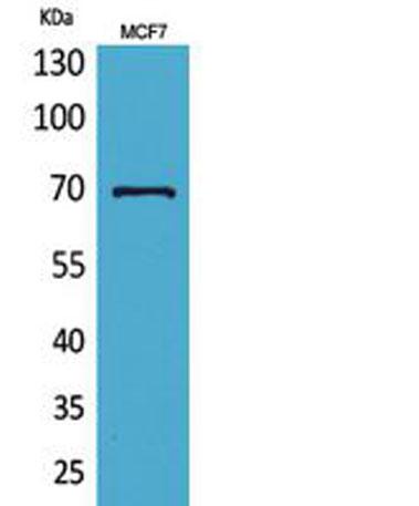 Western Blot analysis of MCF7 cells using HSP70 Polyclonal Antibody. Secondary antibody was diluted at 1:20000