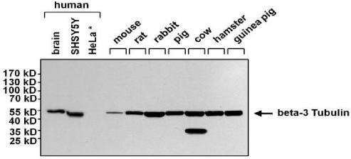 Western Blot analysis using Tubulin Beta III Monoclonal Antibody.