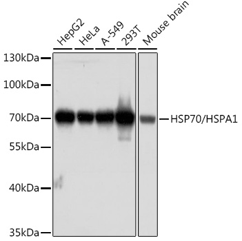 Western blot analysis of extracts of various cell lines, using HSP70 antibody at 1:1000 dilution.
Secondary antibody: HRP Goat Anti-Mouse IgG (H+L) at 1:10000 dilution.
Lysates/proteins: 25ug per lane.
Blocking buffer: 3% nonfat dry milk in TBST.
Detection: ECL Basic Kit.
Exposure time: 60s.