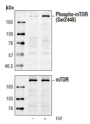 Western blot analysis of extracts from 293 cells (starved for 16 hours) untreated or EGF-treated (100 ng/ml), using PhosphomTOR (Ser2448) Antibody (upper) or control mTOR Antibody (lower).