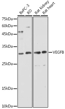 Western blot analysis of extracts of various cell lines, using VEGFB antibody at 1:1000 dilution. Secondary antibody: HRP Goat Anti-Rabbit IgG (H+L) at 1:10000 dilution.
Lysates/proteins: 25ug per lane.
Blocking buffer: 3% nonfat dry milk in TBST.
Detection: ECL Basic Kit.
Exposure time: 30s.