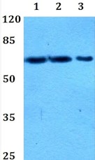 Western Blot on PIF1 Antibody at Dilution 1:1000
Lane 1 : HeLa whole cell lysate
Lane 2 : Raw264.7 whole cell lysate
Lane 3 : PC12 whole cell lysate