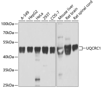 Western blot analysis of extracts of various cell lines, using UQCRC1 antibody at 1:1000
dilution.
Secondary antibody: HRP Goat Anti-Rabbit IgG (H+L) at 1:10000 dilution.
Lysates/proteins: 25ug per lane.
Blocking buffer: 3% nonfat dry milk in TBST.
Detection: ECL West Pico Plus.
Exposure time: 1s.