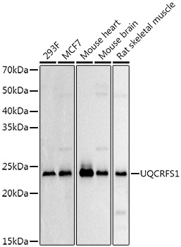 Western blot analysis of extracts of various cell lines, using UQCRFS1 Rabbit pAb antibody at 1:500 dilution.
Secondary antibody: HRP Goat Anti-Rabbit IgG (H+L) at 1:10000 dilution.
Lysates/proteins: 25ug per lane.
Blocking buffer: 3% nonfat dry milk in TBST.
Detection: ECLWest Pico Plus.
Exposure time: 3s.