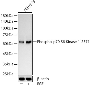 Western blot analysis of NIH/3T3, using Phospho-p70 S6K (S371) antibody at 1:400 dilution. NIH/3T3 cells were treated by EGF (100 ng/ml) at 37℃ for 30 minutes after serum-starvation overnight.
Secondary antibody: HRP Goat Anti-Rabbit IgG (H+L) at 1:10000 dilution.
Lysates/proteins: 25ug per lane.
Blocking buffer: 3% nonfat dry milk in TBST.
Detection: ECL Basic Kit.
Exposure time: 60s.