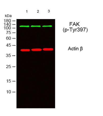 Western blot analysis of lysates from 1) 293T, 2) AD293 ,3)Hela cells, (Green) primary antibody was diluted at 1:1000, 4°over night, secondary antibody was diluted at 1:10000, 37° 1hour. (Red) Actin β Monoclonal Antibody(5B7) 
ant.
