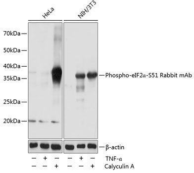Western blot analysis of extracts of various cell lines, using Phospho-eIF2α-S51 Rabbit MAb at 1:1000 dilution. HeLa and NIH/3T3 cells were treated by Calyculin A (100 nM) at 37℃ for 30 minutes after serum-starvation overnight or treated by TNF-α (20 ng/mL) at 37℃ for 30 minutes.
Secondary antibody: HRP Goat Anti-Rabbit IgG (H+L) at 1:10000 dilution.
Lysates/proteins: 25ug per lane.
Blocking buffer: 3% nonfat dry milk in TBST.
Detection: ECL Basic Kit.
Exposure time: 1s.