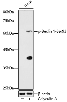 Western blot analysis of extracts of HeLa cells, using Phospho-Beclin 1-Ser93 antibody at 1:500 dilution. HeLa cells were treated by Calyculin A (100 nM) at 37℃ for 30 minutes.
Secondary antibody: HRP Goat Anti-Rabbit IgG (H+L) at 1:10000 dilution.
Lysates/proteins: 25ug per lane.
Blocking buffer: 3% nonfat dry milk in TBST.
Detection: ECL Enhanced Kit.
Exposure time: 180s.