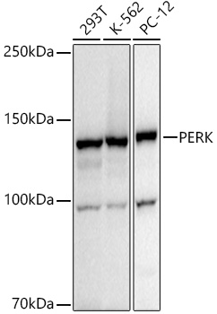 Western blot analysis of extracts of various cell lines, using PERK antibody at 1:1000 dilution.    Secondary antibody: HRP Goat Anti-Rabbit IgG (H+L) at 1:10000 dilution.
Lysates/proteins: 25ug per lane.
Blocking buffer: 3% nonfat dry milk in TBST.
Detection: ECL Basic Kit.
Exposure time: 20s.