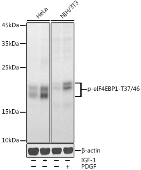 Western blot analysis of extracts of various cell lines, using Phospho-4EBP1 (T37/46) antibody at 1:1000 dilution. HeLa cells were treated by IGF-1 (50 ng/ml) at 37℃ for 30 minutes after serum-starvation overnight. NIH/3T3 cells were treated by PDGF (100 ng/ml) at 37℃ for 30 minutes after serum-starvation overnight.
Secondary antibody: HRP Goat Anti-Rabbit IgG (H+L) at 1:10000 dilution.
Lysates/proteins: 25ug per lane.
Blocking buffer: 3% nonfat dry milk in TBST.
Detection: ECL Enhanced Kit
Exposure time: 30s.