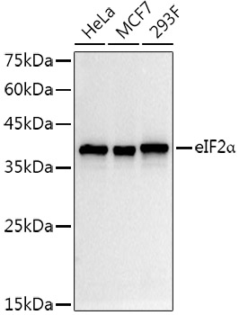Western blot analysis of extracts of various cell lines, using eIF2α antibody at 1:1000 dilution. Secondary antibody: HRP Goat Anti-Rabbit IgG (H+L) at 1:10000 dilution.
Lysates/proteins: 25ug per lane.
Blocking buffer: 3% nonfat dry milk in TBST.
Detection: ECL Basic Kit.
Exposure time: 3s.