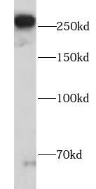 U-87MG cells were subjected to SDS PAGE followed by western blot with Fibronectin antibody at dilution of 1:2000