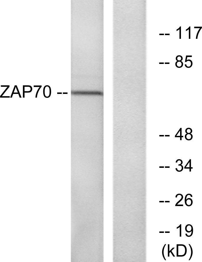 <p style="text-align: left;">Western blot analysis of lysates from Jurkat cells, using ZAP-70 Antibody. The lane on the right is blocked with the synthesized peptide.</p>
