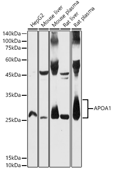 Western blot analysis of extracts of various cell lines, using APOA1 antibody at 1:500dilution.
Secondary antibody: HRP Goat Anti-Rabbit IgG (H+L) at 1:10000 dilution.
Lysates/proteins: 25ug per lane.
Blocking buffer: 3% nonfat dry milk in TBST.
Detection: ECL West Pico Plus.
Exposure time: 30s.