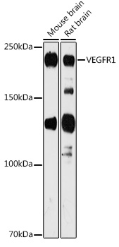 Western blot analysis of extracts of various cell lines, using VEGFR1 antibody at 1:1000
dilution.
Secondary antibody: HRP Goat Anti-Rabbit IgG (H+L) at 1:10000 dilution.
Lysates/proteins: 25ug per lane.
Blocking buffer: 3% nonfat dry milk in TBST.
Detection: ECL West Pico Plus.
Exposure time: 180s.