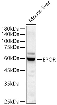 Western blot analysis of Mouse liver, using EPOR antibody at 1:1000 dilution.
Secondary antibody: HRP Goat Anti-Rabbit IgG (H+L) at 1:10000 dilution.
Lysates/proteins: 25ug per lane.
Blocking buffer: 3% nonfat dry milk in TBST.
Detection: ECL West Pico Plus.
Exposure time: 60s.