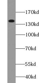 human heart tissue were subjected to SDS PAGE followed by western blot with COL6A1 Antibody at dilution of 1:600